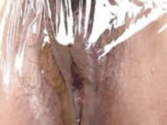 日本語URETHRA ILLUSTRATIONS6.mp4