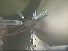 乳首の痛みlove1