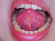 口中・舌・歯フェチ